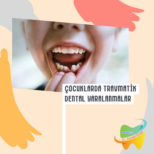 Çocuklarda Travmatik Dental Yaralanmalar
